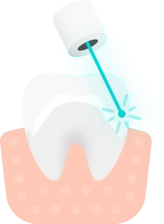 Баннер Металлокерамические коронки Баннер Металлокерамические коронки